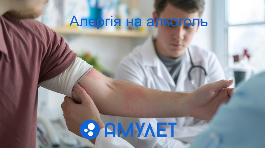 Алергія на алкоголь